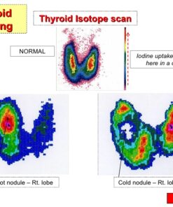 Thyroid Imaging
