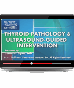 Thyroid Pathology and Ultrasound-Guided Intervention