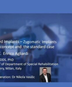 Tilted and Zygomatic Implants - Enrico Agliardi Lectures List