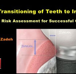 Transitioning of Teeth to Implants: Risk Assessment for Successful Outcome