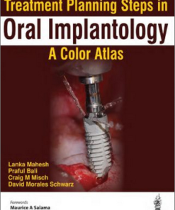 Treatment Planning Steps in Oral Implantology: A Color Atlas