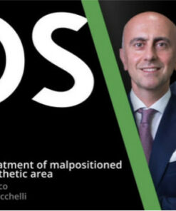 Prosthetic Treatment of Malpositioned Implants in Esthetic Area