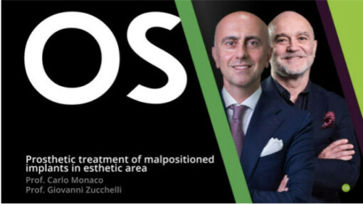 Prosthetic Treatment of Malpositioned Implants in Esthetic Area