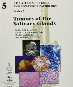 Tumors of the Salivary Glands: Series 5 (Original PDF from Publisher)