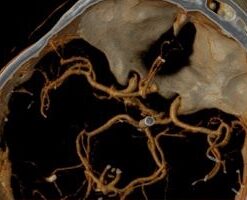 UCSF Interventional Radiology Review