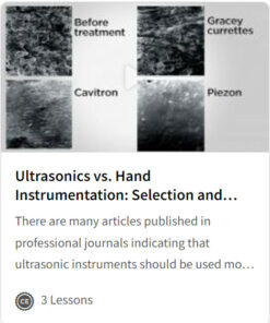 Ultrasonics vs. Hand Instrumentation: Selection and Application
