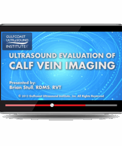 Ultrasound Evaluation for Calf Vein Imaging