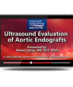 Ultrasound Evaluation of Aortic Endografts