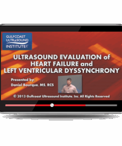 Ultrasound Evaluation of Heart Failure and Left Ventricular Dyssynchrony