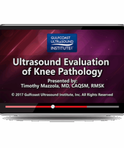 Ultrasound Evaluation of Knee Pathology