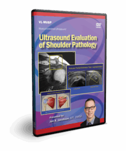 Ultrasound Evaluation of Shoulder Pathology