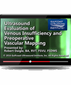 Ultrasound Evaluation of Venous Insufficiency and Preoperative Vascular Mapping