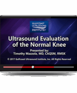 Ultrasound Evaluation of the Normal Knee