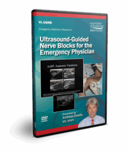 Ultrasound-Guided Nerve Blocks for the Emergency Physician