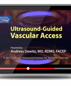 Ultrasound-Guided Vascular Access