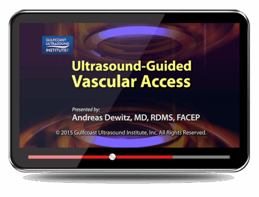 Ultrasound-Guided Vascular Access