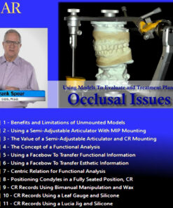 SPEAR Using Models To Evaluate and Treatment Plan Occlusal Issues - Frank Spear