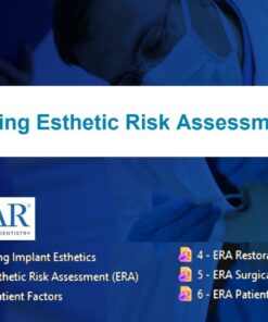 SPEAR Utilizing Esthetic Risk Assessment