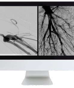 Vascular and Interventional Radiology