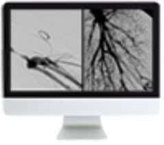 Vascular and Interventional Radiology Review