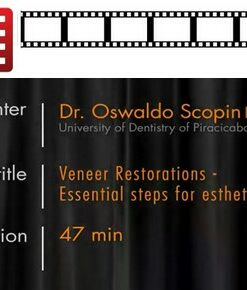 Veneer Restorations – Essential Step For Esthetic Success (Video)