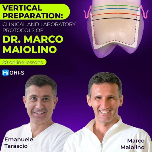 OHI-S Vertical Preparation: Team Approach, Clinic+Dental Lab - Marco Maiolino, Emanuele Tarascio