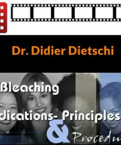 Vital Bleaching: Indications, Principles & Procedures