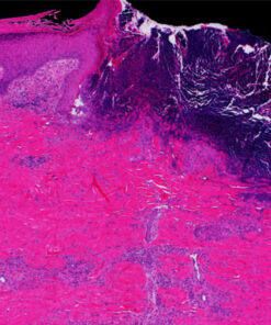 Mayo Clinic Wound Symposium: The Edges Of Wound Care 2023 (Videos+Assessment Quiz)