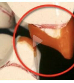 Classic Collection: Worn Dentition