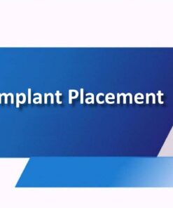 Zimmer Biomet Implant Placement