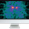 Arrs clinical case based review of nuclear medicine 2019 medical video courses 368468 540x.jpg