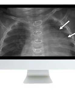 ARRS Clinical Case-Based Review of Pediatric Imaging 2019