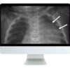 Arrs clinical pediatric imaging review 2019 medical video courses 108722 720x.jpg