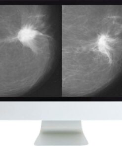 ARRS Harmonizing Breast Cancer Screening Recommendations Hybrid Course 2018