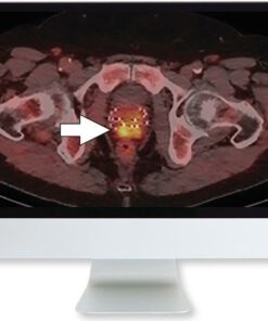 ARRS Molecular Imaging and Therapy of Prostate Cancer 2020