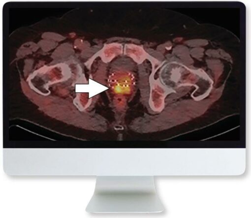 ARRS Molecular Imaging and Therapy of Prostate Cancer 2020