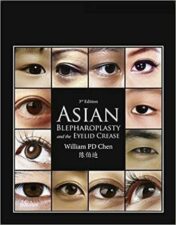 ASIAN blepharoplasty and the eyelid crease original pdf+221 video's