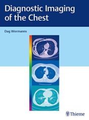 Diagnostic Imaging of the Chest (Original PDF)