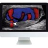 Clinical ultrasound review arrs medical video courses 684841 540x.jpg