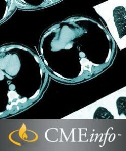 CME VIDEO PDF Thoracic Imaging 2016