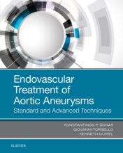 Endovascular Treatment of Aortic Aneurysms: Standard and Advanced Techniques, 1st Edition (PDF)