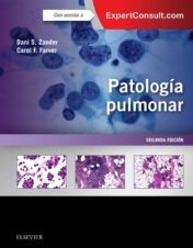 Patología pulmonar + ExpertConsult (Spanish Edition) (PDF)