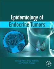 Epidemiology of Endocrine Tumors Original PDF 2021