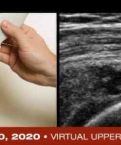 Fundamentals of Musculoskeletal Ultrasound 2020