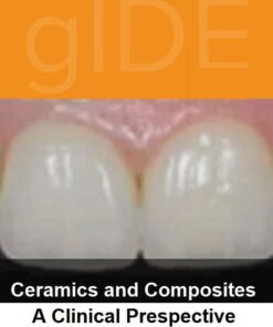 gIDE online lectures - Ceramic and Composits, A Clinical Perspective   