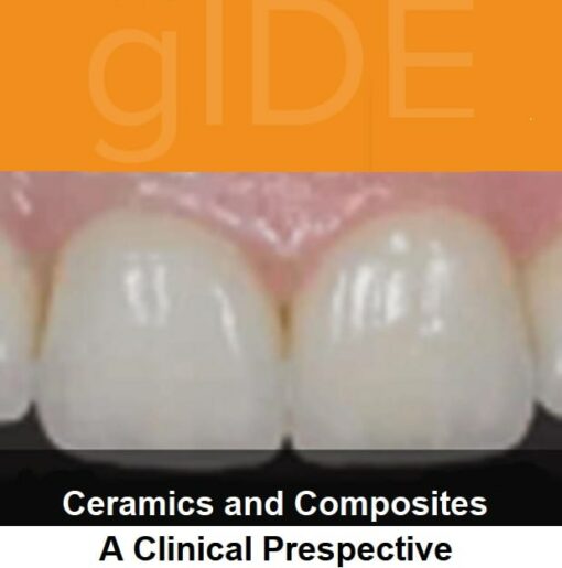 gIDE online lectures - Ceramic and Composits, A Clinical Perspective   
