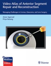 Video Atlas of Anterior Segment Repair and Reconstruction: Managing Challenges in Cornea, Glaucoma, and Lens Surgery (PDF)