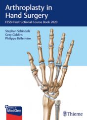 Arthroplasty in Hand Surgery original PDF 2020