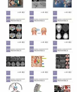 Journal of Neurosurgery: Pediatrics 2022 Full Archives (True PDF)