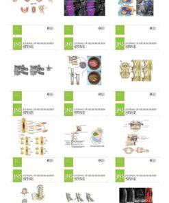 Journal of Neurosurgery: Spine 2022 Full Archives (True PDF)
